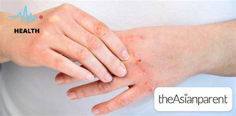 sugat sa kamay in english|Sugat: Tagalog to English.